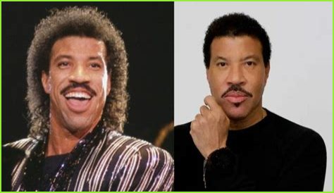 The American Idol Judge Before and After Botox, Facelift and Hair Transplant!